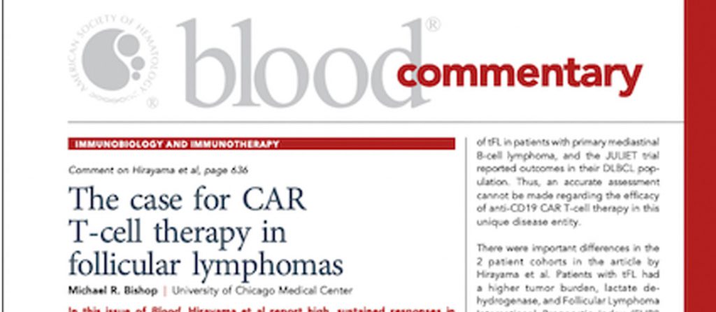 Positive results for CAR T-cell Therapy in Follicular Lymphoma