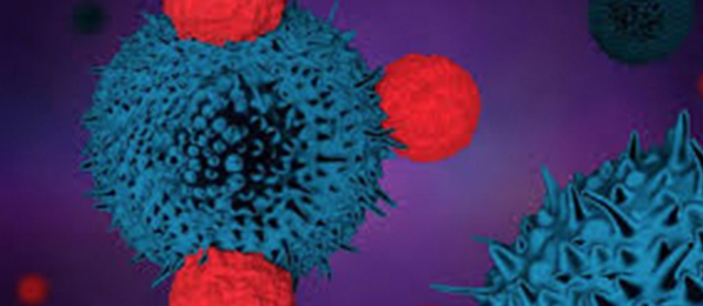 CAR T-cell Therapy rejected for funding in DLBCL