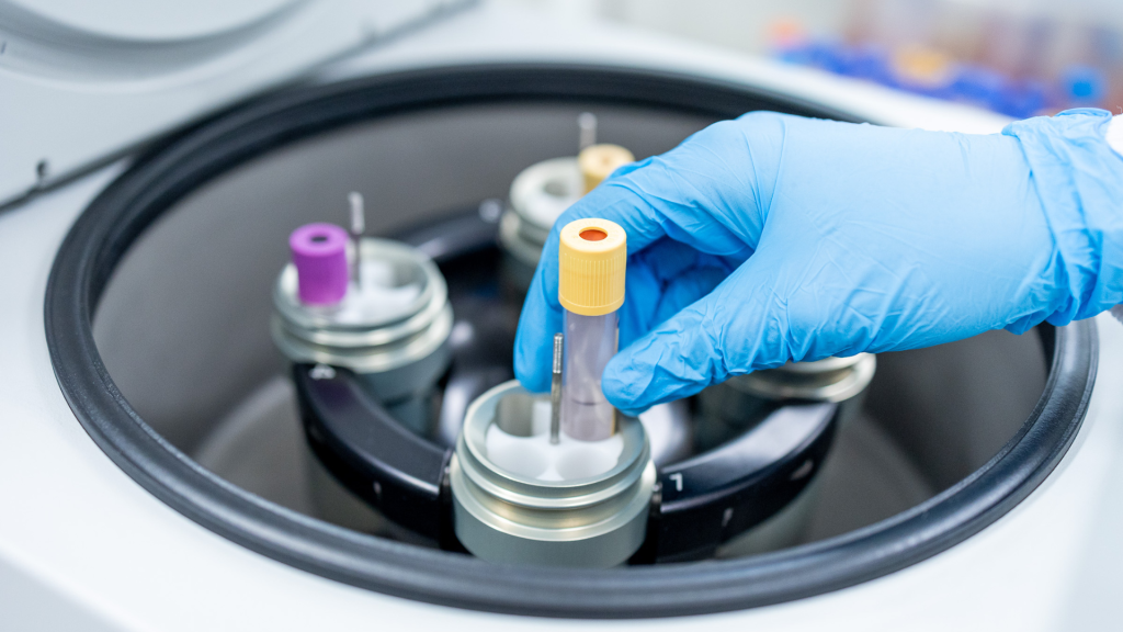 Blood Cancer Patients Join a Global Clinical Trial at Epworth