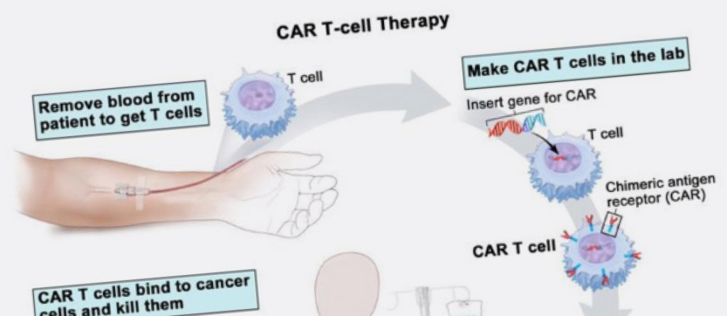 CAR T-cell therapy
