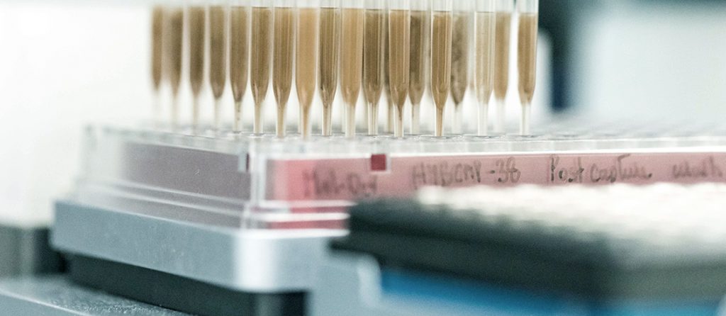 CAR T-cell therapy to be funded by Medical Benefits Scheme for Acute Lymphoblastic Leukaemia